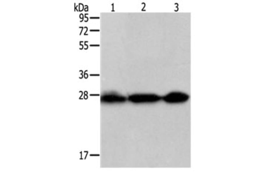 PDCD10 Antibody from Signalway Antibody (31110) - Antibodies.com