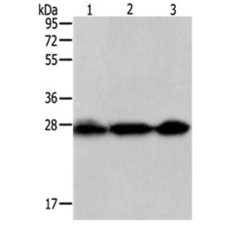 PDCD10 Antibody from Signalway Antibody (31110) - Antibodies.com