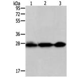 PDCD10 Antibody from Signalway Antibody (31110) - Antibodies.com