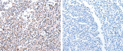 The image on the left is immunohistochemistry of paraffin-embedded human tonsil tissue using 31110 (PDCD10 Antibody) at dilution 1/20, on the right is treated with the fusion protein.