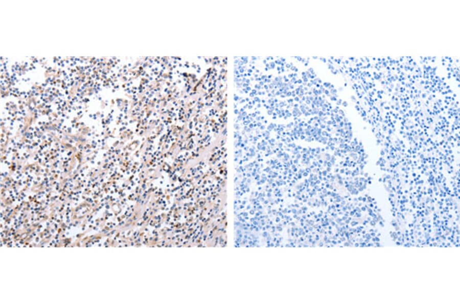 PDCD10 Antibody from Signalway Antibody (31110) - Antibodies.com
