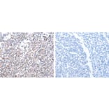 PDCD10 Antibody from Signalway Antibody (31110) - Antibodies.com