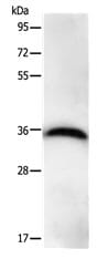 Gel: 10% SDS-PAGE Lysate: 40 µg Hela cell lysate  Primary antibody: 1/450dilution Secondary antibody: Goat anti Rabbit IgG - H&L (HRP) at 1/10000 dilution Exposure time: 20 seconds