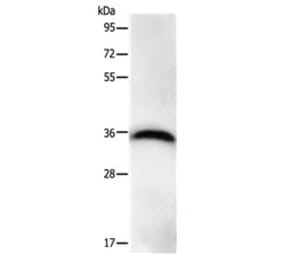 PPP1CB Antibody from Signalway Antibody (31114) - Antibodies.com