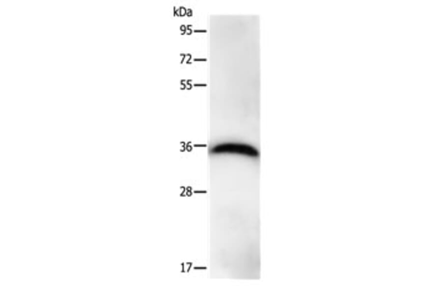 PPP1CB Antibody from Signalway Antibody (31114) - Antibodies.com