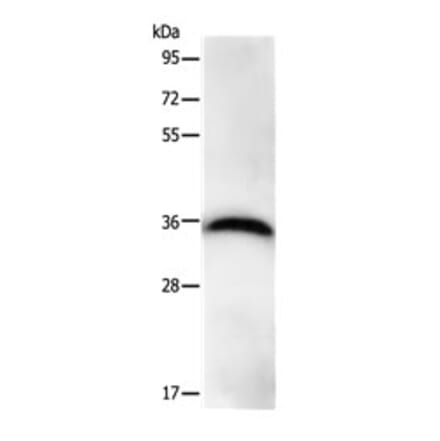 PPP1CB Antibody from Signalway Antibody (31114) - Antibodies.com