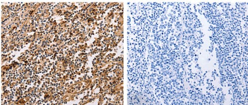 The image on the left is immunohistochemistry of paraffin-embedded human tonsil tissue using 31114 (PPP1CB Antibody) at dilution 1/30, on the right is treated with the fusion protein.