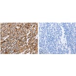 PPP1CB Antibody from Signalway Antibody (31114) - Antibodies.com