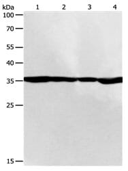 Gel: 10% SDS-PAGE Lane1: 293T cell lysate Lane2: SKOV3 cell lysateLane3: NIH/3T3 cell lysateLane4: 231 cell lysate. Lysates: 50 µg per lane. Primary antibody: 1/200 dilution. Secondary antibody: Goat anti Rabbit IgG - H&L (HRP) at 1/10000 dilution. Exposure time: 1 minute