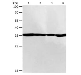 PSMD14 Antibody from Signalway Antibody (31120) - Antibodies.com