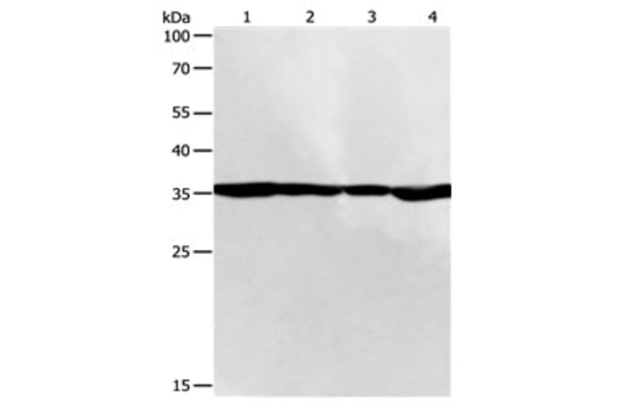 PSMD14 Antibody from Signalway Antibody (31120) - Antibodies.com