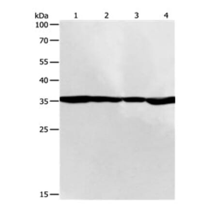 PSMD14 Antibody from Signalway Antibody (31120) - Antibodies.com