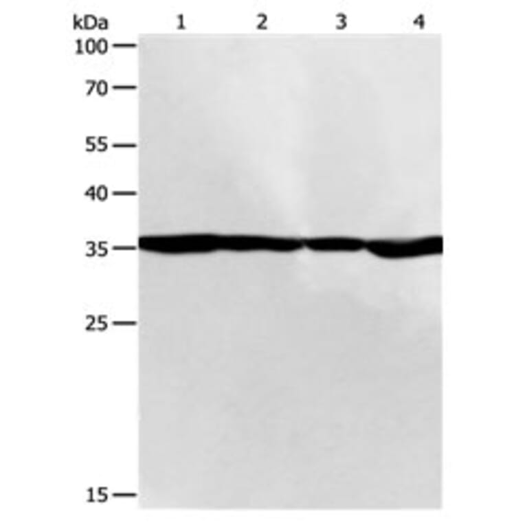 PSMD14 Antibody from Signalway Antibody (31120) - Antibodies.com