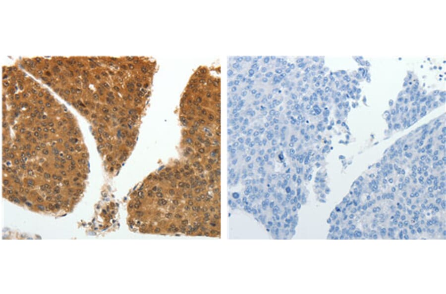 PSMD14 Antibody from Signalway Antibody (31120) - Antibodies.com