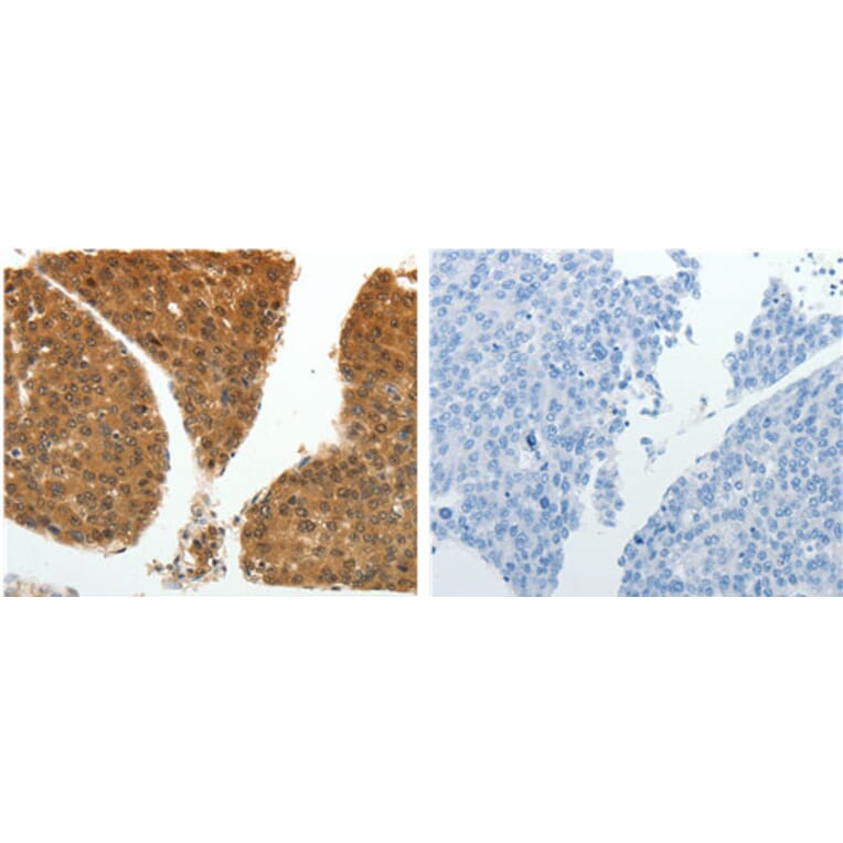 PSMD14 Antibody from Signalway Antibody (31120) - Antibodies.com