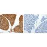 PSMD14 Antibody from Signalway Antibody (31120) - Antibodies.com