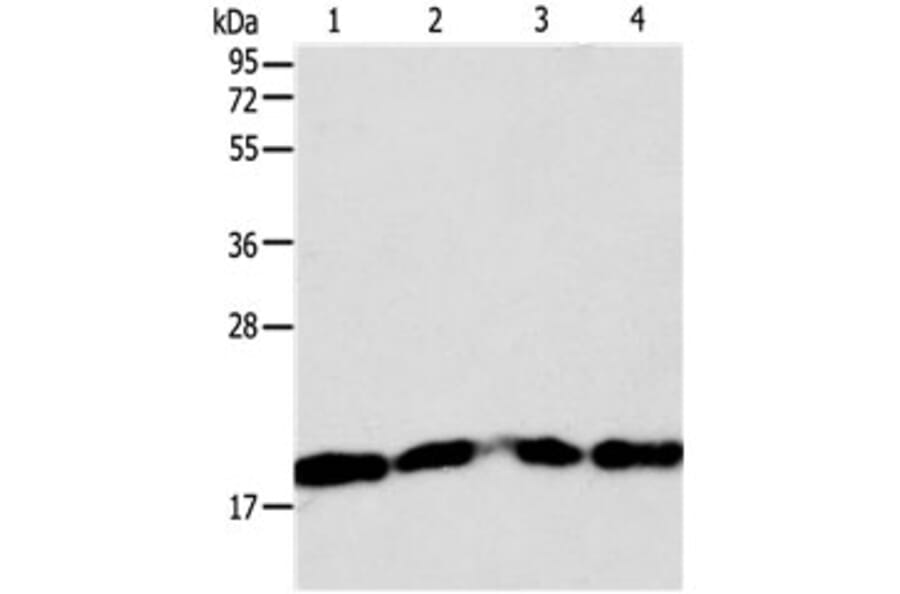 DIABLO Antibody from Signalway Antibody (31125) - Antibodies.com