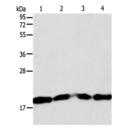 DIABLO Antibody from Signalway Antibody (31125) - Antibodies.com