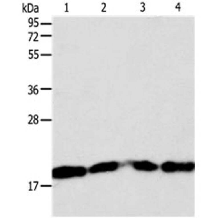 DIABLO Antibody from Signalway Antibody (31125) - Antibodies.com