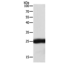 SNAP25 Antibody from Signalway Antibody (31127) - Antibodies.com