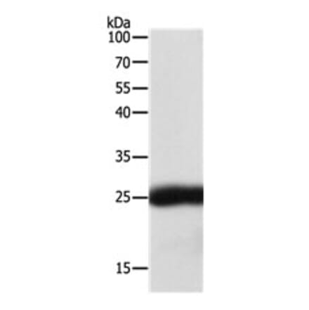 SNAP25 Antibody from Signalway Antibody (31127) - Antibodies.com