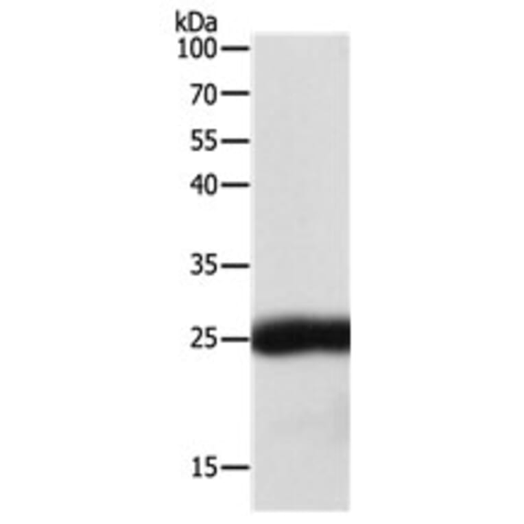SNAP25 Antibody from Signalway Antibody (31127) - Antibodies.com