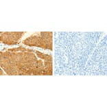 SNAP25 Antibody from Signalway Antibody (31127) - Antibodies.com
