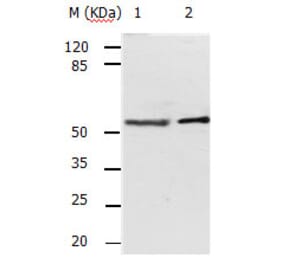 ACVR2A Antibody from Signalway Antibody (31159) - Antibodies.com