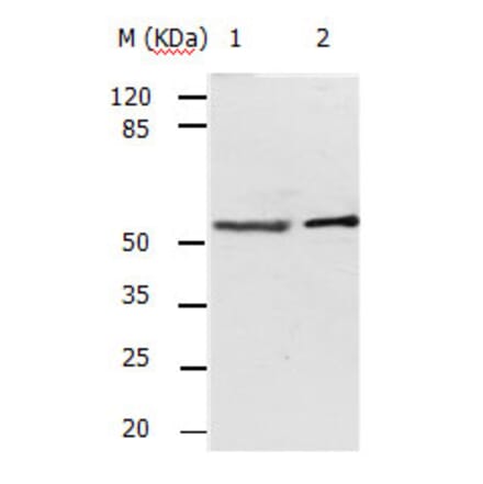 ACVR2A Antibody from Signalway Antibody (31159) - Antibodies.com