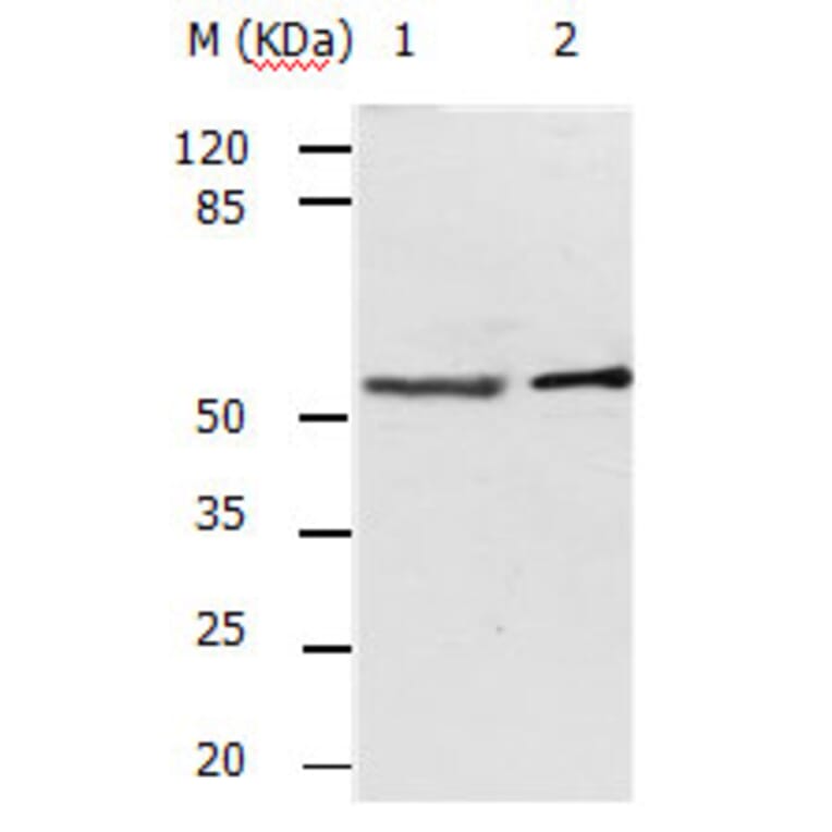 ACVR2A Antibody from Signalway Antibody (31159) - Antibodies.com