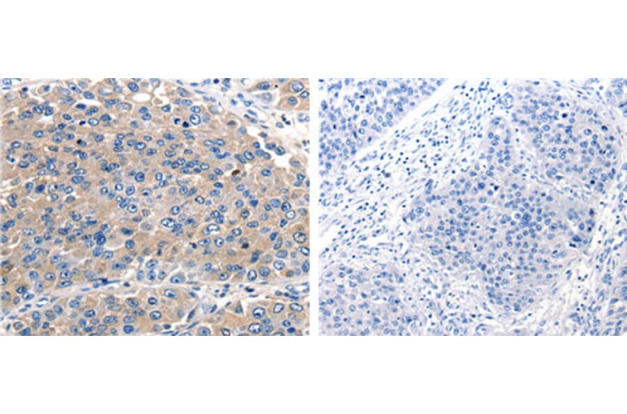 ACVR2A Antibody from Signalway Antibody (31159) - Antibodies.com