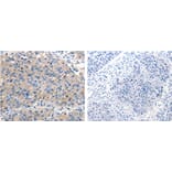 ACVR2A Antibody from Signalway Antibody (31159) - Antibodies.com