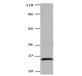 CSNK2B Antibody from Signalway Antibody (31171) - Antibodies.com