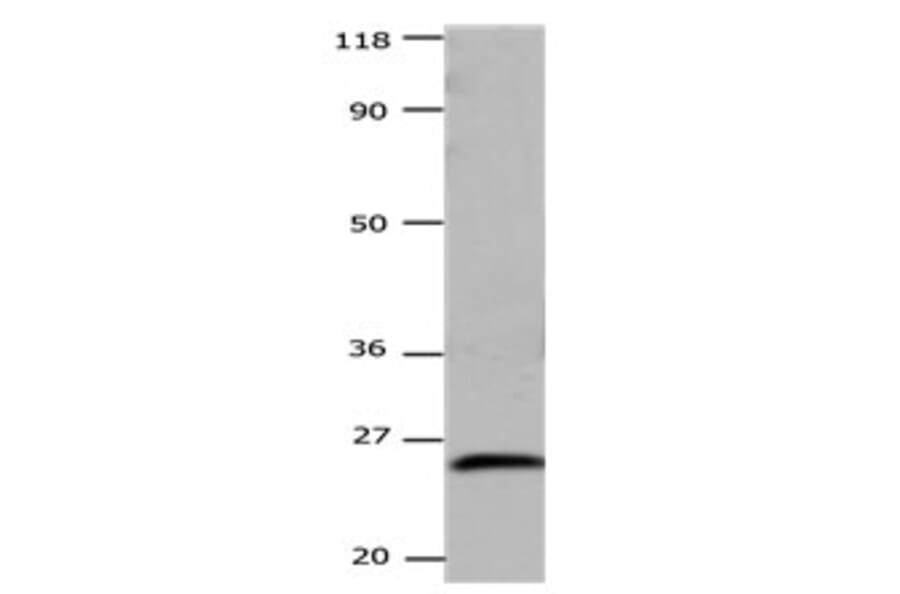 CSNK2B Antibody from Signalway Antibody (31171) - Antibodies.com