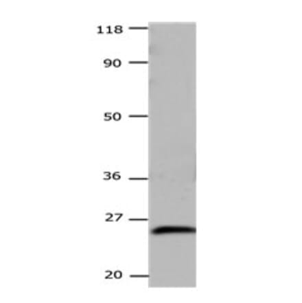 CSNK2B Antibody from Signalway Antibody (31171) - Antibodies.com