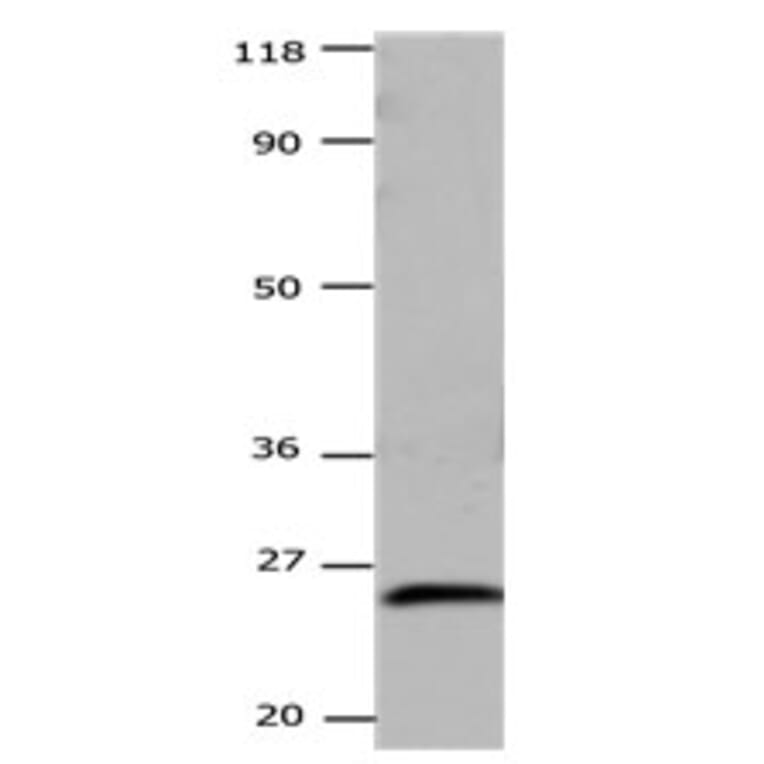 CSNK2B Antibody from Signalway Antibody (31171) - Antibodies.com