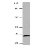 CSNK2B Antibody from Signalway Antibody (31171) - Antibodies.com