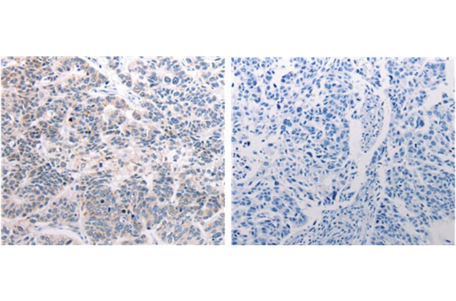 CSNK2B Antibody from Signalway Antibody (31171) - Antibodies.com