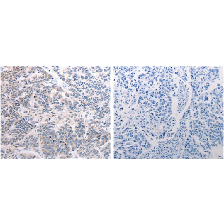 CSNK2B Antibody from Signalway Antibody (31171) - Antibodies.com