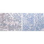 CSNK2B Antibody from Signalway Antibody (31171) - Antibodies.com