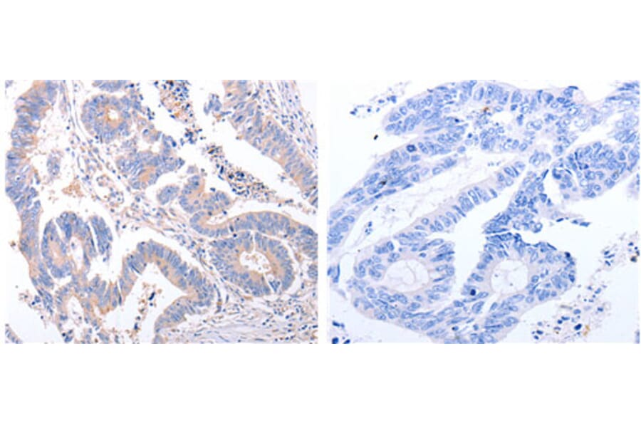 EIF4G2 Antibody from Signalway Antibody (31184) - Antibodies.com