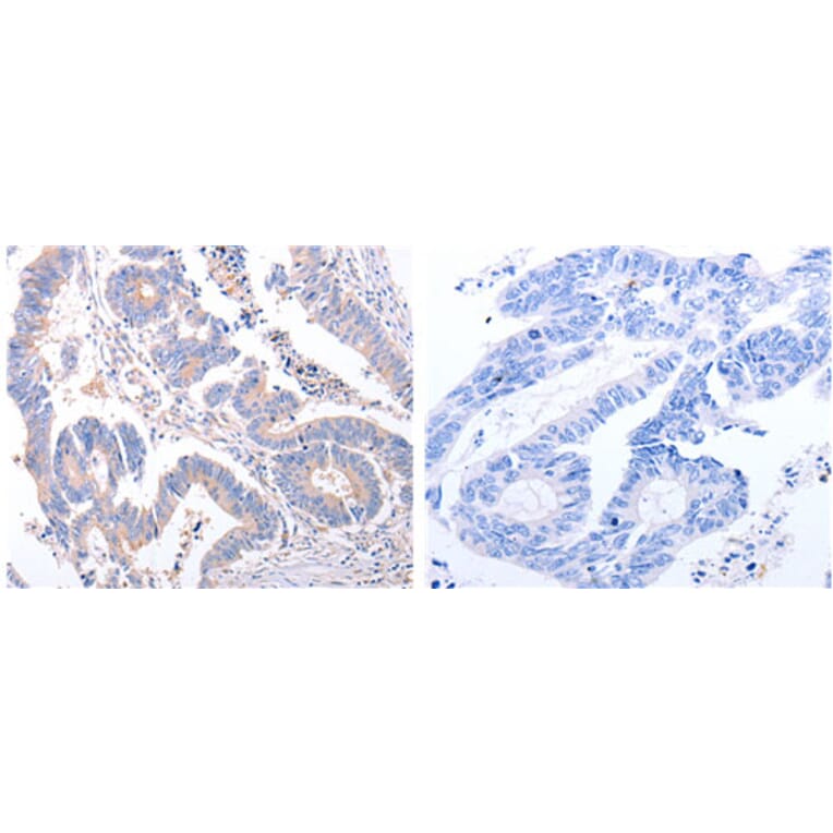EIF4G2 Antibody from Signalway Antibody (31184) - Antibodies.com