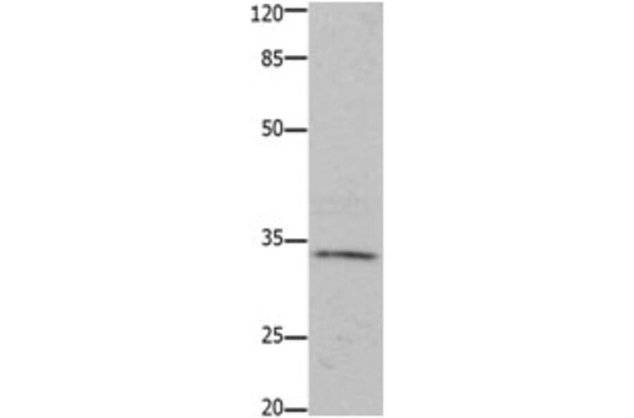 HOXA11 Antibody from Signalway Antibody (31221) - Antibodies.com