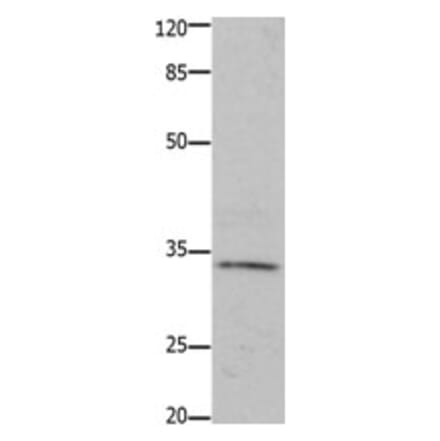 HOXA11 Antibody from Signalway Antibody (31221) - Antibodies.com