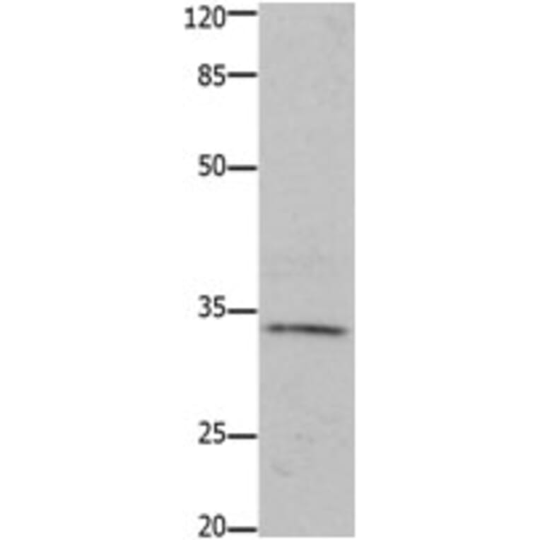 HOXA11 Antibody from Signalway Antibody (31221) - Antibodies.com