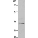 HOXA11 Antibody from Signalway Antibody (31221) - Antibodies.com