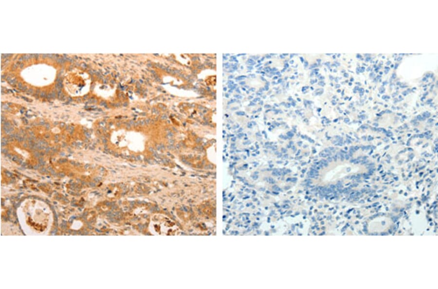 HOXA11 Antibody from Signalway Antibody (31221) - Antibodies.com