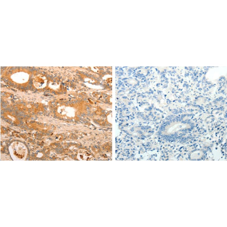 HOXA11 Antibody from Signalway Antibody (31221) - Antibodies.com