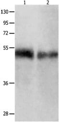 Gel: 10% SDS-PAGE Lane1: Human tongue tissue lysate Lane2: Human laryngo carcinoma tissue lysate. Lysates: 50 µg per lane. Primary antibody: 1/500 dilution. Secondary antibody: Goat anti Rabbit IgG - H&L (HRP) at 1/10000 dilution. Exposure time: 1 minute