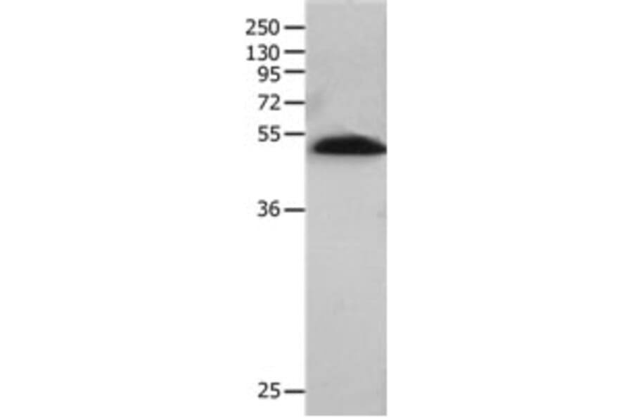 BPIFB2 Antibody from Signalway Antibody (31230) - Antibodies.com